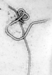 103px-Ebola_virus_em